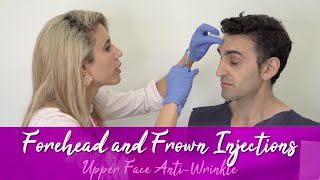 Upper Face AntiWrinkle Injections  34 SAFE INJECTING WALKTHROUGH [upl. by Uot]