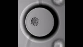 The first six days Embryo developing in Geri incubator camera [upl. by Justicz320]