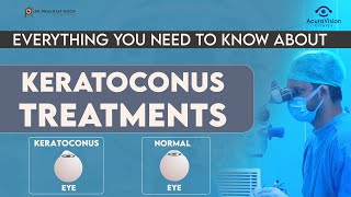 Everything You Need To Know About Keratoconus Treatments 15 मिनट में [upl. by Mandell]