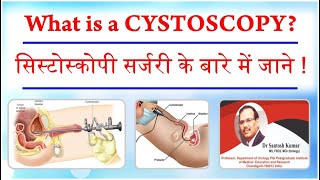 What is a Cystoscopy  सिस्टोस्कोपी सर्जरी के बारे में जाने  DrProfSantosh Kumar PGI [upl. by Selway356]