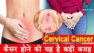 इतना खतरनाक होता है Cervical Cancerजानें इसके लक्षण और कारणSymptoms Of Cervical Cancer [upl. by Anitan]