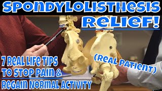 Spondylolisthesis Relief 7 Real Life Tips to Stop Pain amp Regain Normal Activity Real Patient [upl. by Cohn]