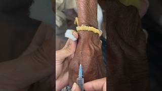 How to give iv injection  नस में इंजेक्शन कैसे लगायें [upl. by Gentes]