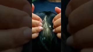 ASMR Scratching amp Dandruff Removal 😴 [upl. by Denney846]