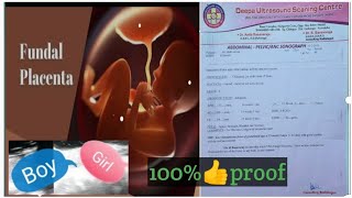 fundal anterior placenta baby gender mothervlogs57 [upl. by Cirtemed566]