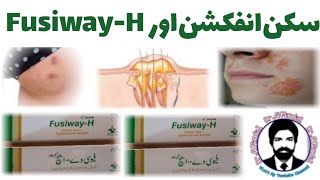 FusiwayH Cream  FusiwayH Best in Skin Infection  DrAHMandal Urdu  Hindi [upl. by Lagas482]