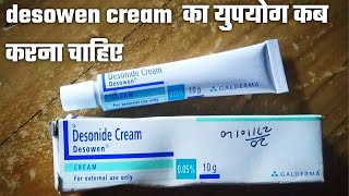 Desowen cream uses in hindi Desonide cream 005 ww  Desonide cream  Desowen cream price [upl. by Ertha]