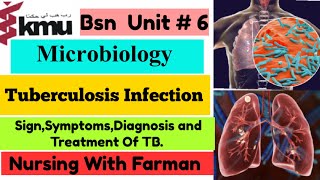 Tuberculosis Infection in UrduHindi  Microbiology Unit  6 KMU  TB Sign Symptoms and Treatment [upl. by Anavoj]