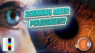 Scanning laser polarimetry Your EYEBALLS 👁️👁️💉😳💊🔊💯✅ [upl. by Adnoved]