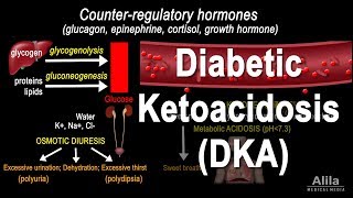 Diabetic Ketoacidosis DKA Pathophysiology Animation [upl. by Annauj893]