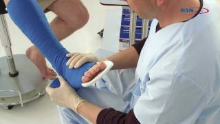 Synthetic splinting reinforced posterior leg splintENby BSN medical [upl. by Wyndham]