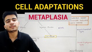 Metaplasia  Cell Adaptations 33  General Pathology  EOMS [upl. by Abby]