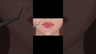 lipcare ASMR animation chapped lips treatment catchy ASMR asmranimation asmrvideo animation [upl. by Beatty190]