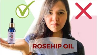 NYKAA ROSEHIP OIL  Benefits My experience Before and After Nykaa naturals essential oil range [upl. by Galvan]