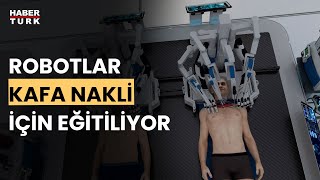 Kafa nakli gerçek mi oluyor Alphan Manas yanıtladı [upl. by Yednil]