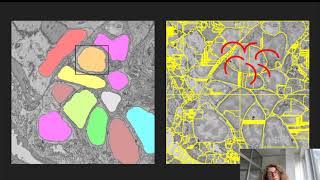 Anna Kreshuk quotWholeorganism segmentation finding all cells in an EMimaged platynereis dumerilii” [upl. by Marcelo377]