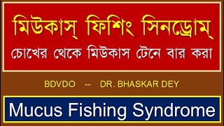 Mucus Fishing Syndrome Bangla mucus mucusFishingSyndromedryEyes conjunctivitis blepharitis [upl. by Merrell]