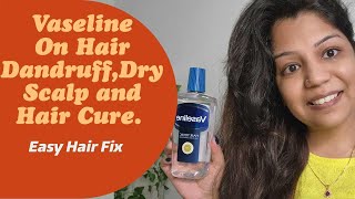 Vaseline On Hair Dandruff Treatment Dry Scalp Health Dry Hair Remedy Hair Tonic Review [upl. by Nwahsirhc]