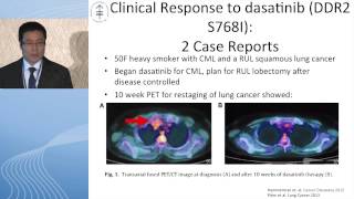 Squamous cell carcinoma Is there hope for targeted therapy [upl. by Durkin]