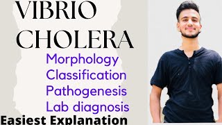 Cholera  Vibrio Cholerae  Pathophysiology  Risk Factors  Symptoms  Diagnosis amp Treatment [upl. by Monafo]