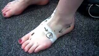 FFT Functional Fascial Taping Lisfranc rupture P2 of 2 [upl. by Dlanigger]