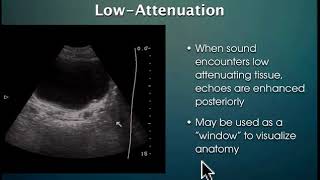 Bladder UltrasoundKUB [upl. by Aramoiz525]