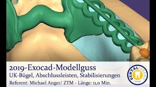 2019EXOCAD  Tutorial Exocad Modellguss UKBügel Abschlussleisten Stabilisierungen [upl. by Arly]