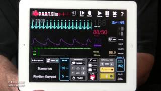 Using the DART Sim App To Teach SVT And Synchronized Cardioversion [upl. by Acisej]