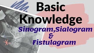 Basic knowledge of Sinogram Sialogram amp Fistulagram Ep51 Sinography  SialogramFistulagraphy [upl. by Tsugua]