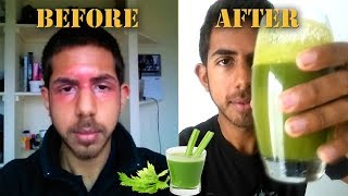 Juicing for Clear Skin  Why YOU should juice daily [upl. by Henrik912]