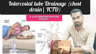 ICTD Chest tube insertion Pneumothorax treatment Thoracostomy procedure [upl. by Selie]