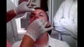 Taponamiento Nasal Posterior por Dr Eliseo Ramirez [upl. by Pachton]