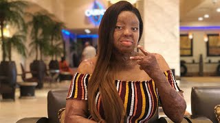 Sosoliso crash survivor Kechi Okwuchi celebrates at 30 [upl. by Ahsenaj]