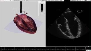 HeartWorks Doppler Features [upl. by Lerraj]