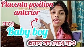 Usg report এ placenta position anterior মানে ছেলে সন্তান প্রমাণসহ দেখে নাও Desi queen ponchu [upl. by Aynos305]