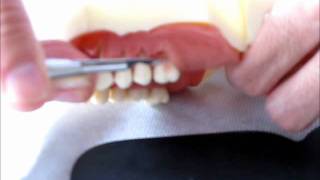 Cirurgia plástica periodontal em modelo Dentart [upl. by Elise767]