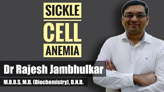 Sickle cell anemia [upl. by Telocin]