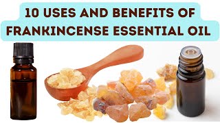 10 Uses and Benefits of Frankincense Essential Oil [upl. by Parry203]