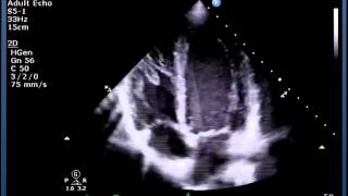 Understanding Echo Standard Imaging Views [upl. by Christine391]