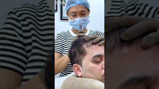 Cara Clinic Hair PRP Treatment Everything You Need to Know [upl. by Russ888]