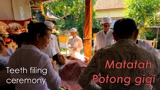 Tooth filing ceremony  Matatah  Upacara Potong Gigi [upl. by Atinor301]