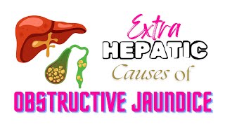 Extrahepatic causes of obstructive jaundice jaundice anatomy [upl. by Dace632]