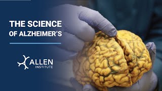 The Science of Alzheimers Brain Awareness Week 2023 [upl. by Anirdna]