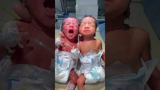 Twinsmedical baby youtubeshorts viral [upl. by Chaille]