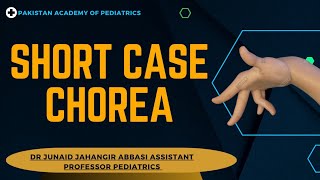 Short Case Chorea  Teaching on Patient [upl. by Nnyletak]