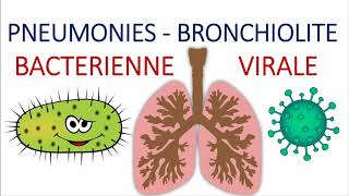 Comment différencier entre une pneumonie aigue communautaire bactérienne et virale atypique [upl. by Rajewski]