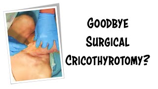 Can the Ventrain Make Surgical Cricothyrotomy a Thing of the Past [upl. by Nilyram520]