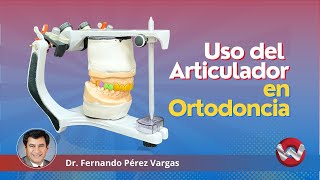 Porque Usar Articulador en Ortodoncia [upl. by Indys]