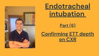 Endotracheal intubation part 6 Confirming the ETT depth with CXR [upl. by Tormoria494]