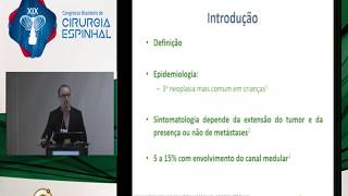 Tratamento da compressão medular por neuroblastoma  Dr Cleiton Formentin [upl. by Alletneuq]